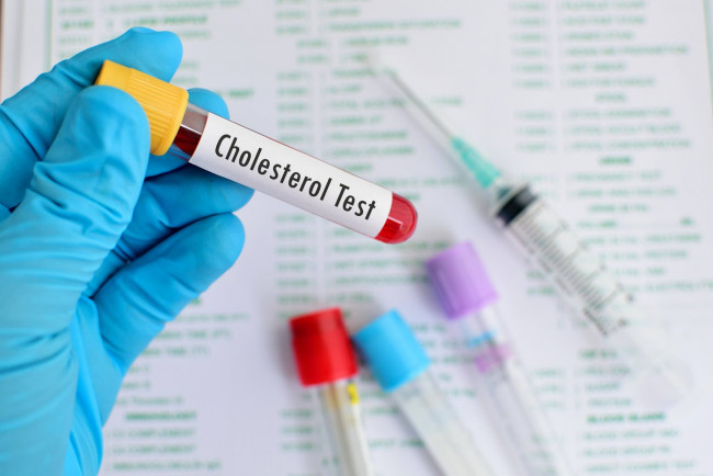 Gratis cholesteroltest bij de ACY apotheken