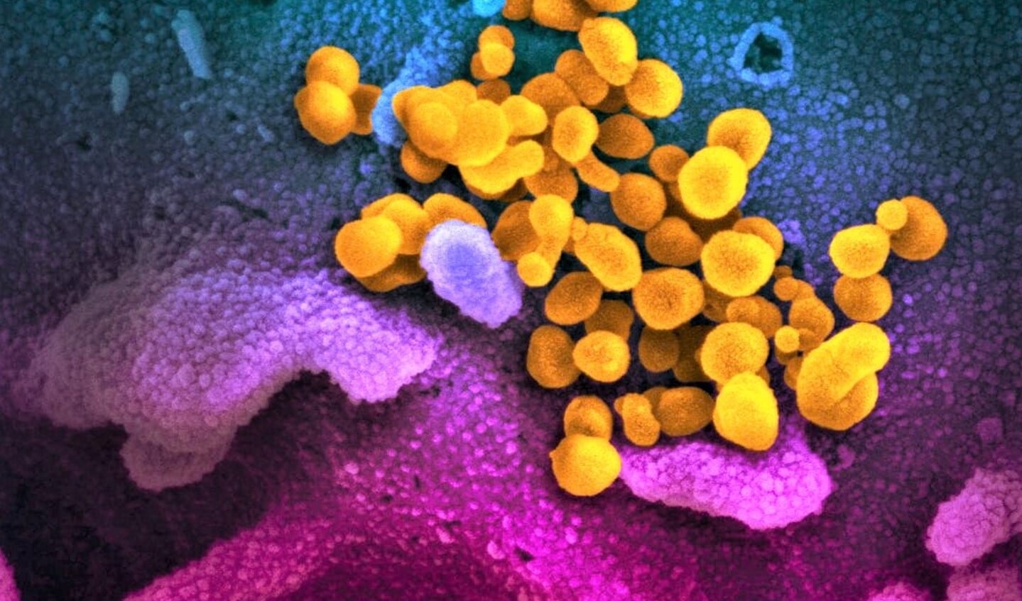 Coronavirus (foto: RIVM).