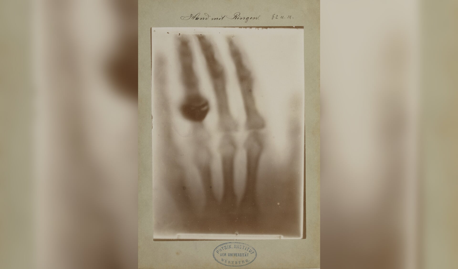 Röntgenfoto door Wilhelm Conrad Röntgen: hand van Röntgens vrouw, 22 december 1895.