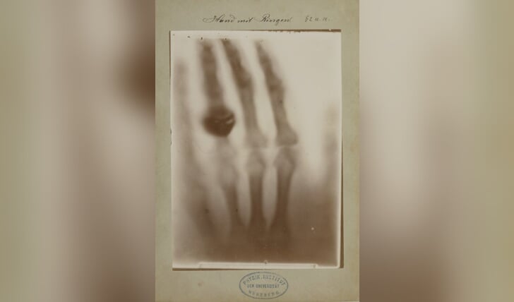 Röntgenfoto door Wilhelm Conrad Röntgen: hand van Röntgens vrouw, 22 december 1895.