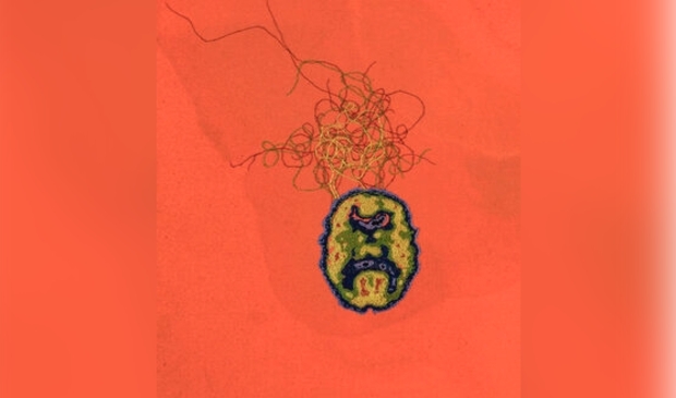 <p>Detail of Schizophrenia Stain (chatter).</p>