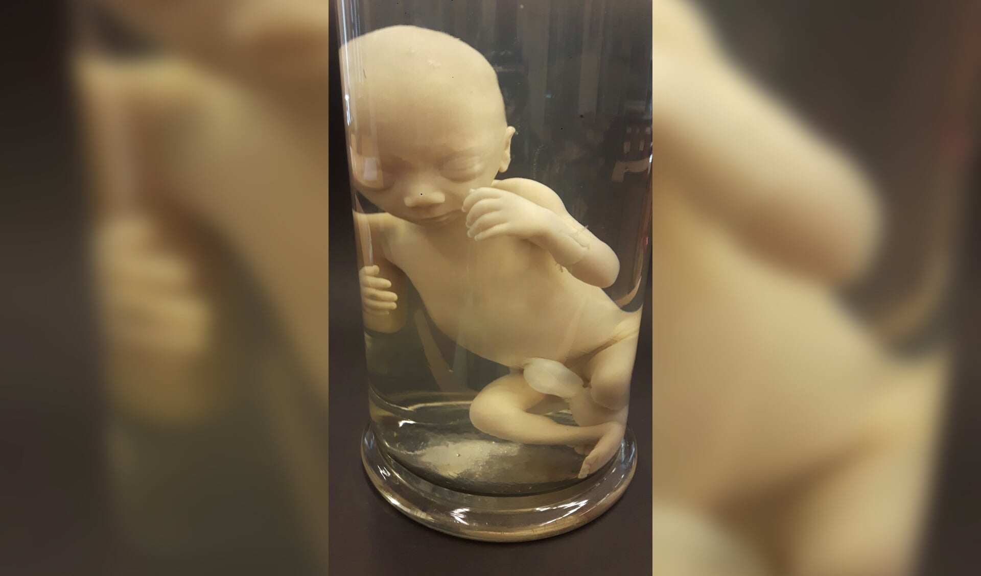 Menselijk embryo op sterk water te zien tijdens de expositie 'Ademloos bewonderd'.