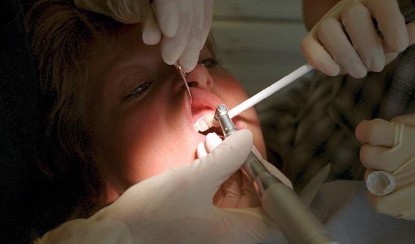 Ordningen med tilbud til tandpleje for de 18-21 kan blive en økonomisk tandpine for Aabenraa Kommune. Arkivfoto:
