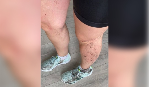 De vrouw bleek meer schade te hebben opgelopen aan de aanrijding dan ze in eerste instantie dacht.