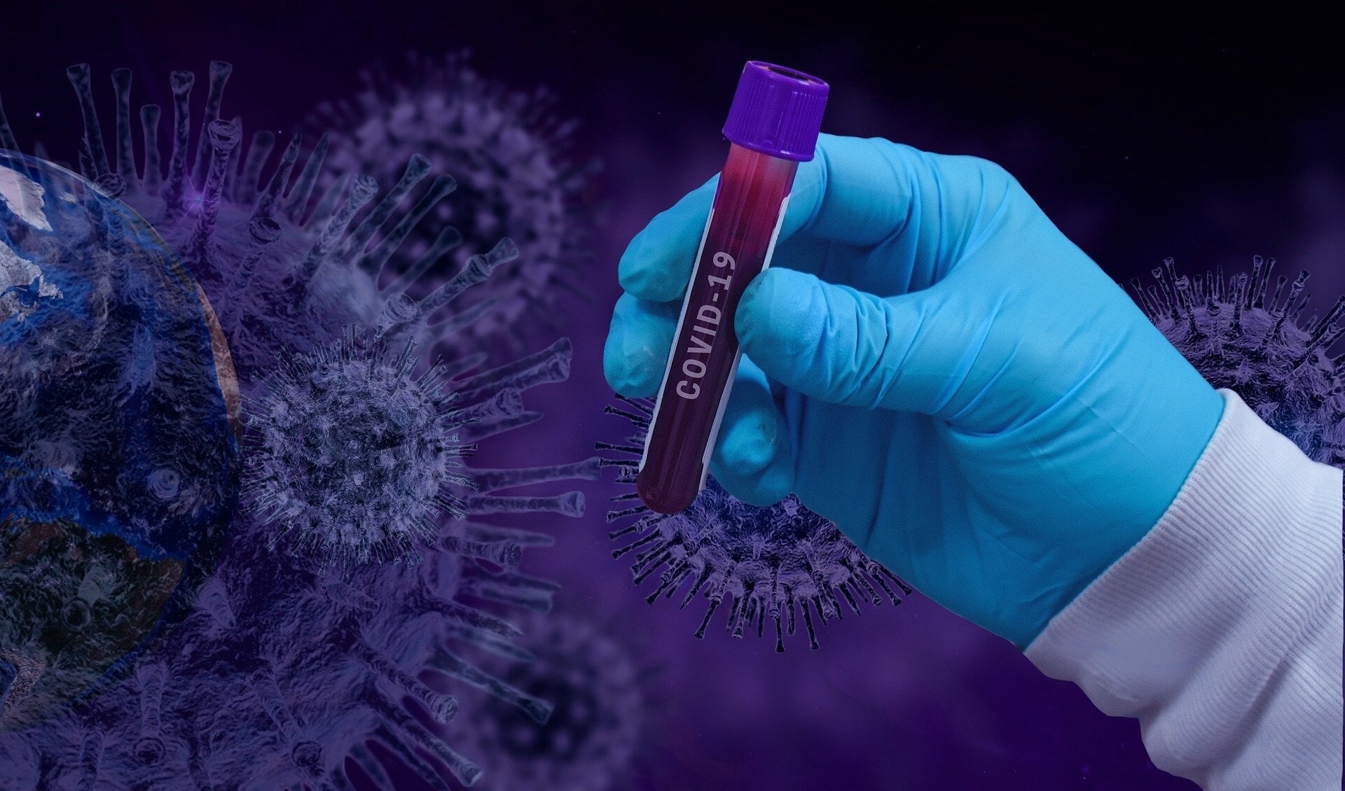 Tussen 24 november en 7 december werd bij 1.250 inwoners van Amstelveen een besmetting met het coronavirus vastgesteld.