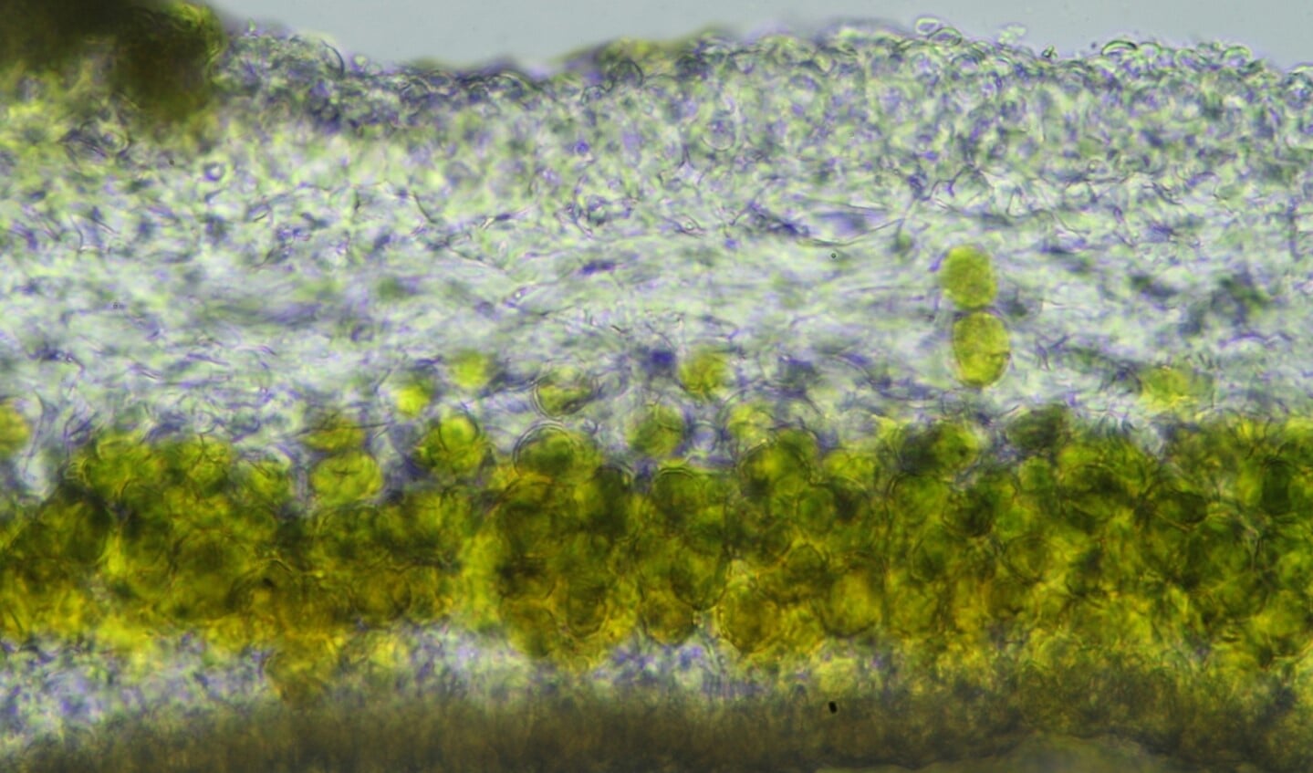 Een microscoop maakt de structuur van korstmos zichtbaar: groene algen- en witachtige schimmelcellen.