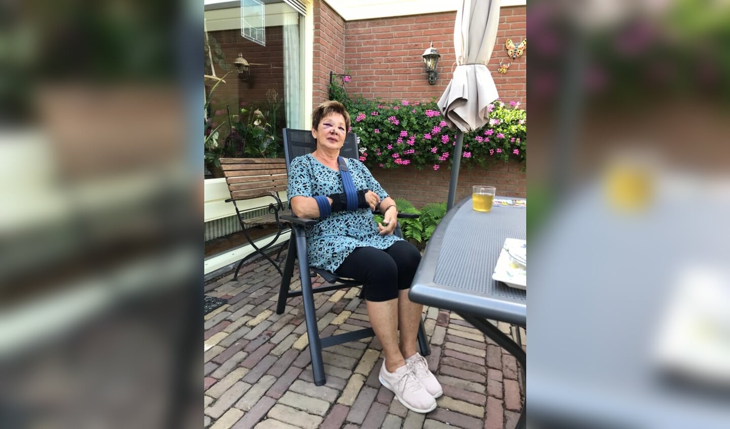 Peggy Bartman de dag na haar fietsongeluk op de Langbroekerdijk, waarbij de tractor doorreed
