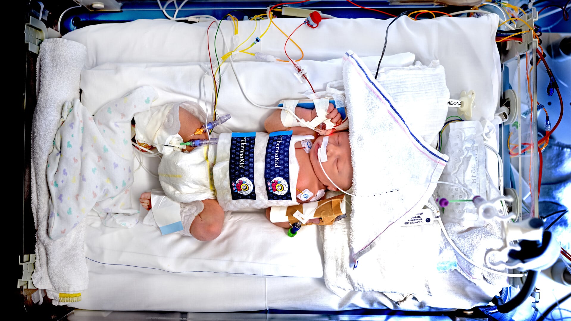 Een heel 'gewoon' beeld op de baby intensive care van het Wilhelmina Kinderziekenhuis in Utrecht. ,,Alle kinderen hebben hier een infuus nodig.''