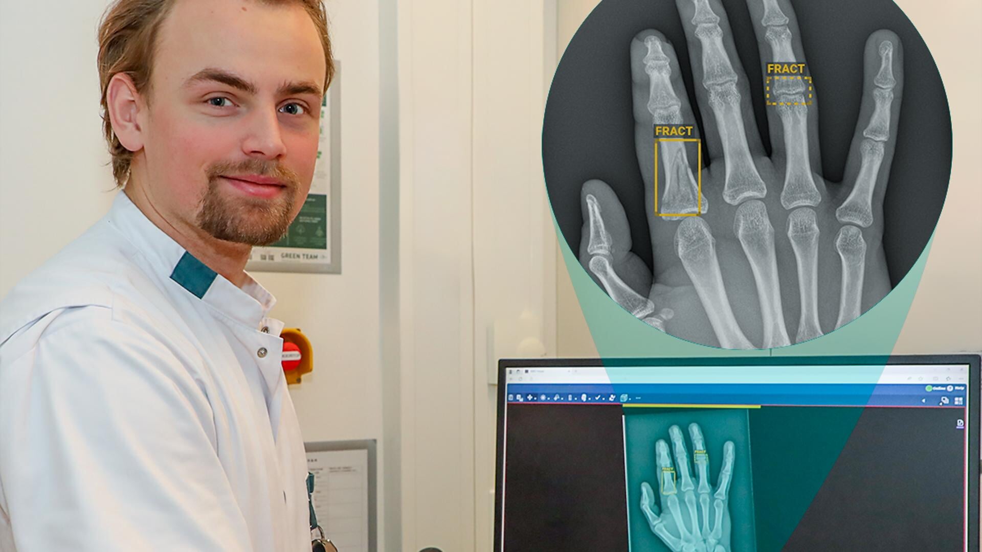 Radiodiagnostisch laborant David Korlaar toont op de monitor een röntgenfoto waarop de AI software botbreuken heeft geïdentificeerd.