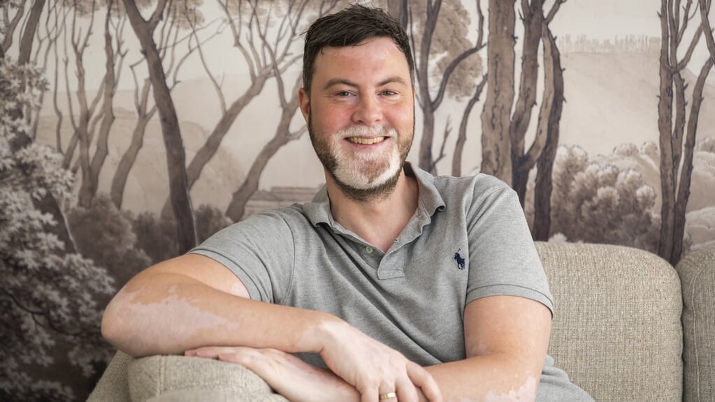 Marc van Ravenhorst: ,,Dankzij vitiligo heb ik oog voor mensen die anders zijn, dat maakt me juist een mooier mens.”