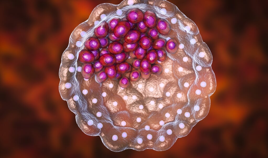 Paren met een verhoogd risico op een ernstige erfelijke ziekte kunnen met het onderzoek hun embryo’s laten testen. (beeld Getty Images/iStockphoto)