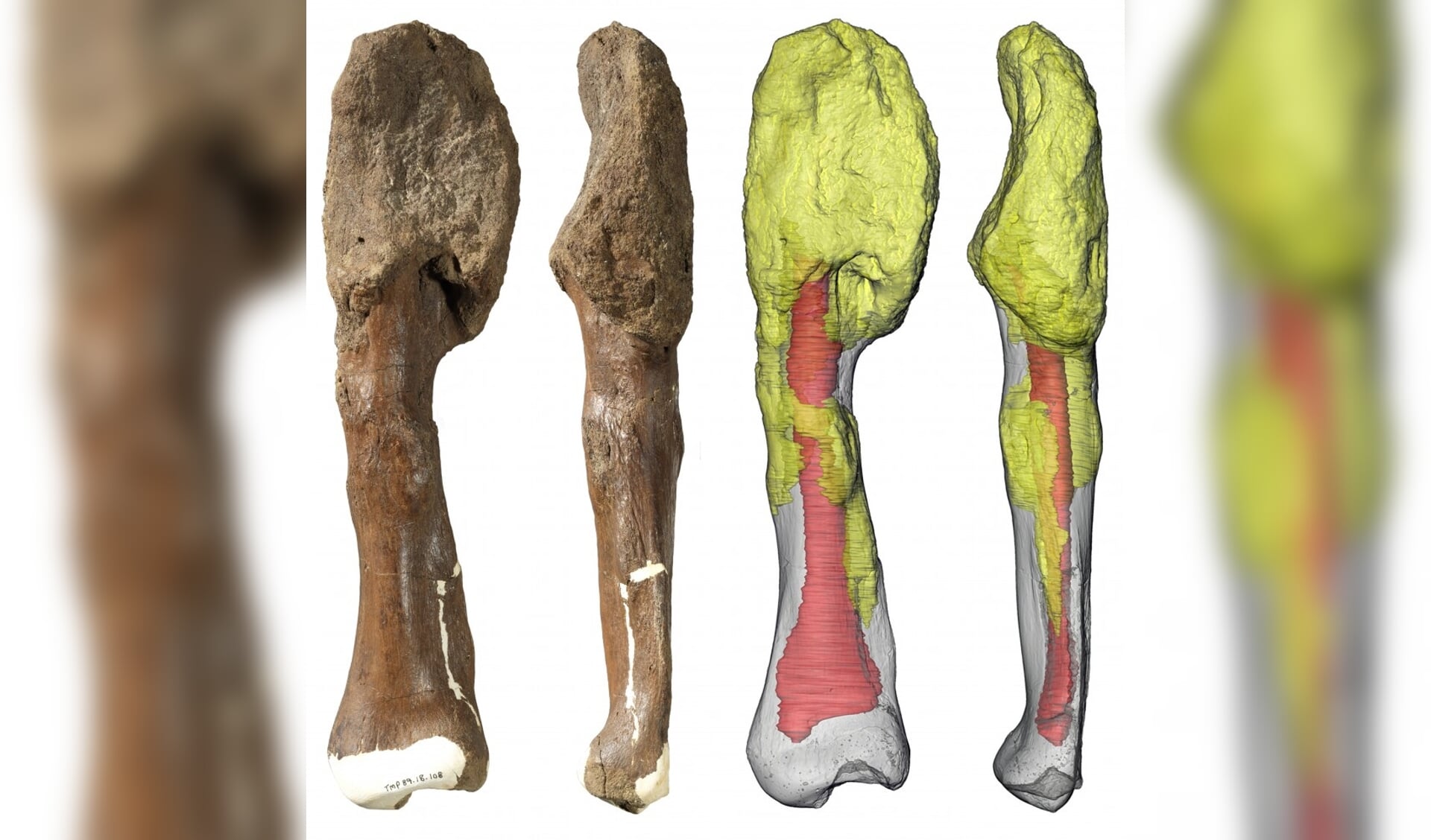 Kuitbeen van een dinosaurus met botkanker. Door de kanker is de bovenkant van het bot vervormd.