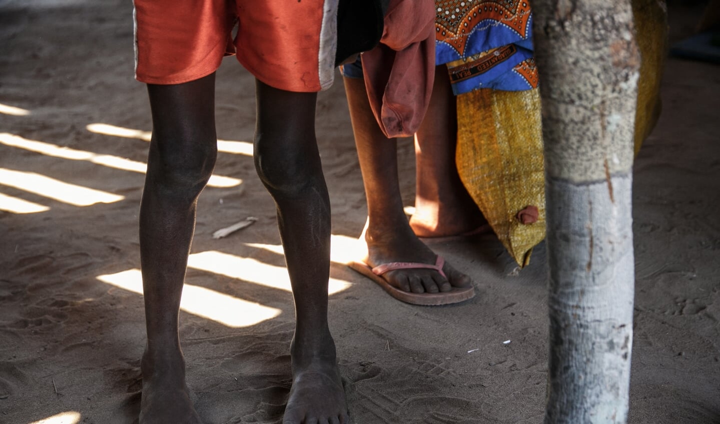 Een meisje wacht op haar beurt om gewogen te worden in het dorpje Tanarake in Madagaskar.  