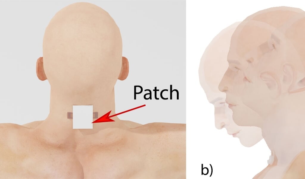De illustratie laat zien hoe de sensor in de nek wordt geplakt, om de plotselinge beweging van het hoofd (rechts) te meten.  (beeld Juan Pastrana)