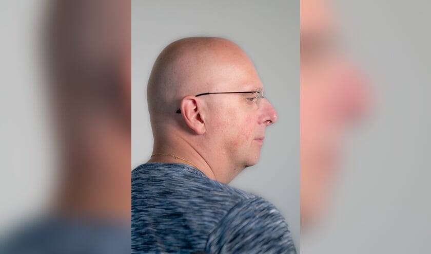 Arie Zwitser leeft met de gevolgen van een dubbel herseninfarct.