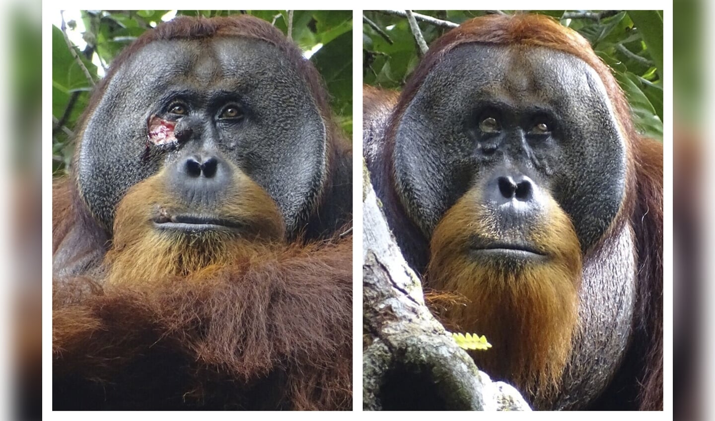 This combination of photos provided by the Suaq foundation shows a facial wound on Rakus, a wild male Sumatran orangutan in Gunung Leuser National Park, Indonesia, on June 23, 2022, two days before he applied chewed leaves from a medicinal plant, left, and on Aug. 25, 2022, after his facial wound was barely visible. (Armas, Safruddin/Suaq foundation via AP)
