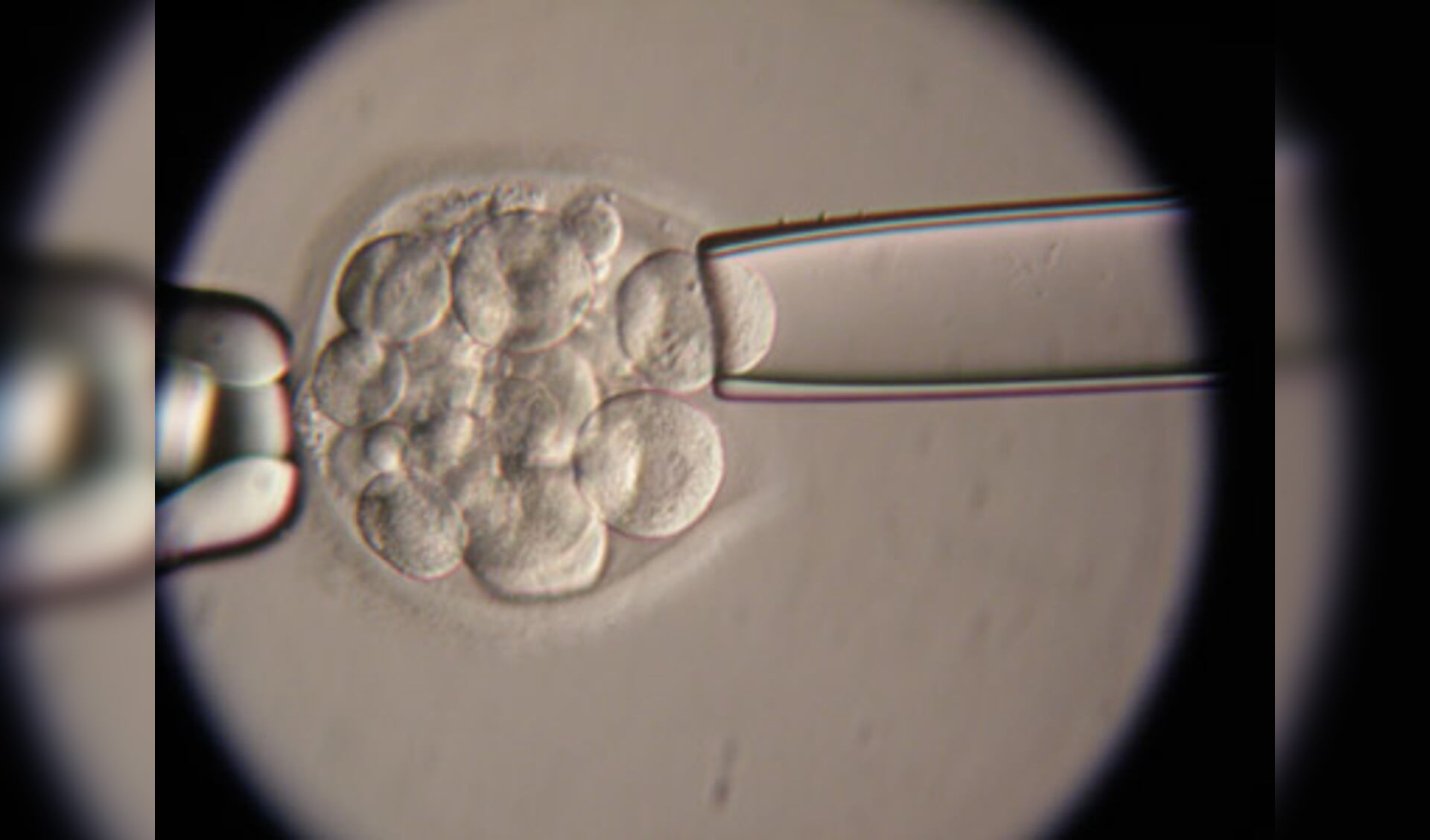 Embryoselectie vraagt om moreel debat