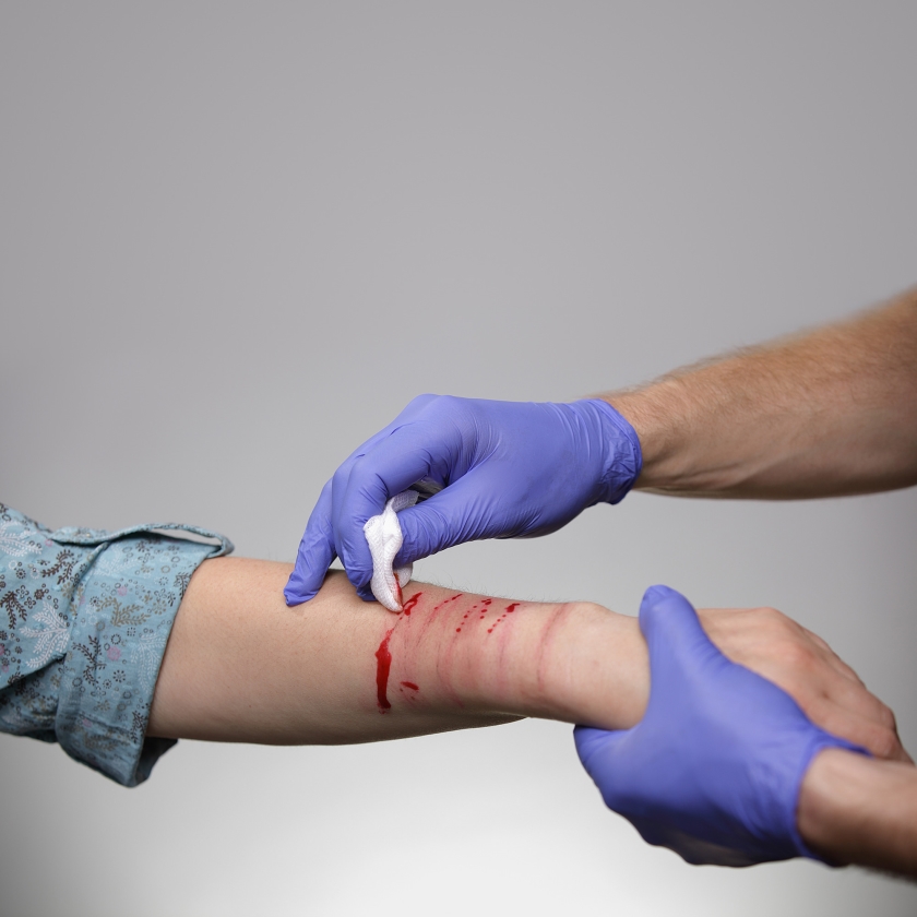 Bij zelfbeschadiging worden mensen overspoeld door emoties als gevolg van bijvoorbeeld seksueel misbruik of een persoonlijkheidsstoornis. (istock en nd)