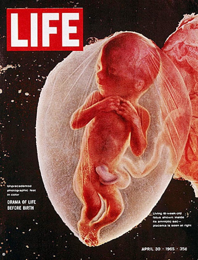 De foto van een ongeboren baby die het magazine LIFE plaatste. (Lennart Nilsson)