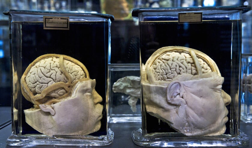 De hersenwetenschappen laten zien welke mechanismen een rol spelen in ons denken over God en goden. een collectie preparaten in het anatomisch museum Vrolik in het Amsterdam Medisch Centrum. (Evert Elzinga)