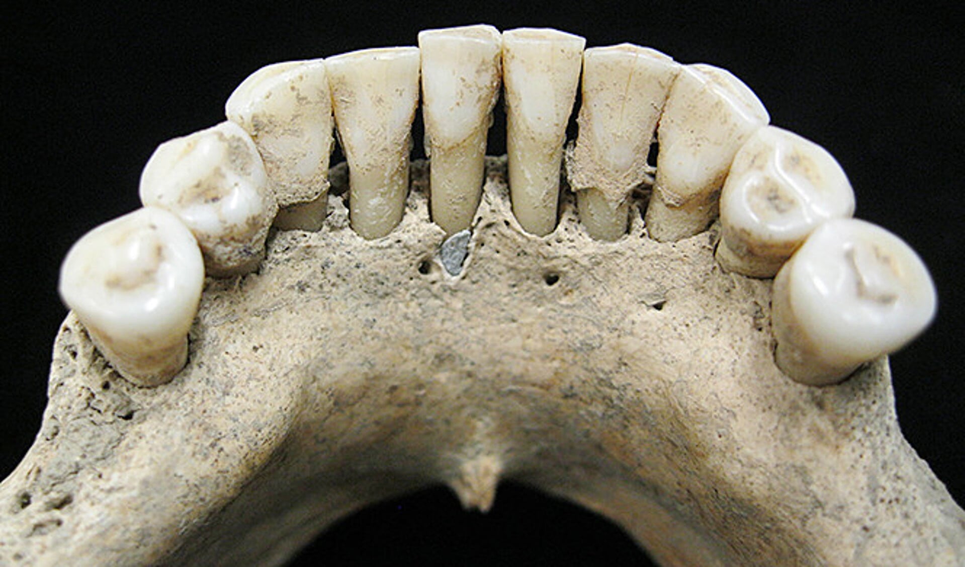 Circa honderd korrels van ultramarijn pigment bevatte de tandplak van een vrouw uit de elfde eeuw.
