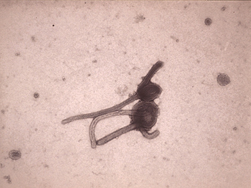 Microscopische opname ebolavirus. (Instituut voor Tropische Geneeskunde Antwerpen en ap / Abbas Dulleh)