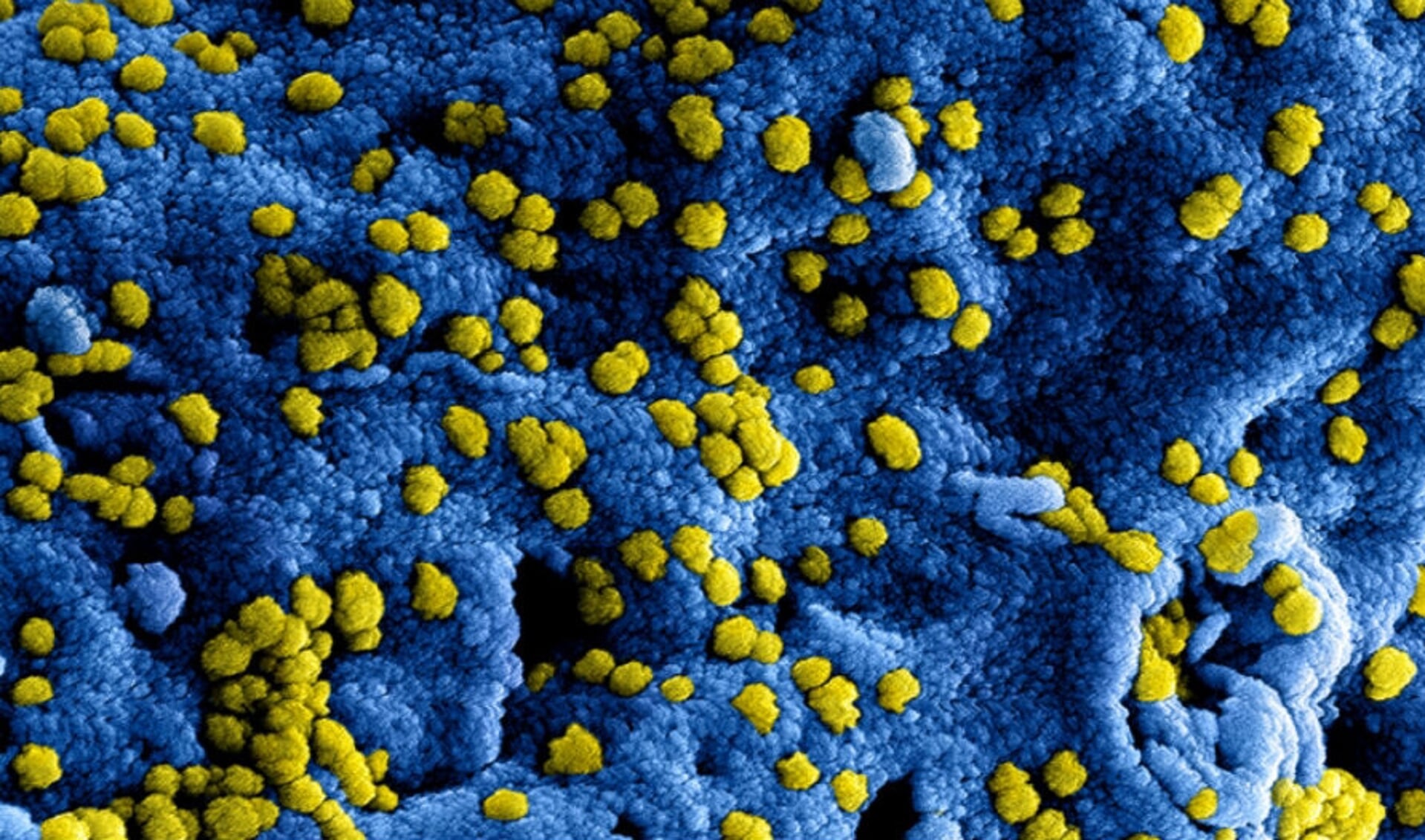 In Cuijk is een tweede besmetting met het coronavirus geconstateerd