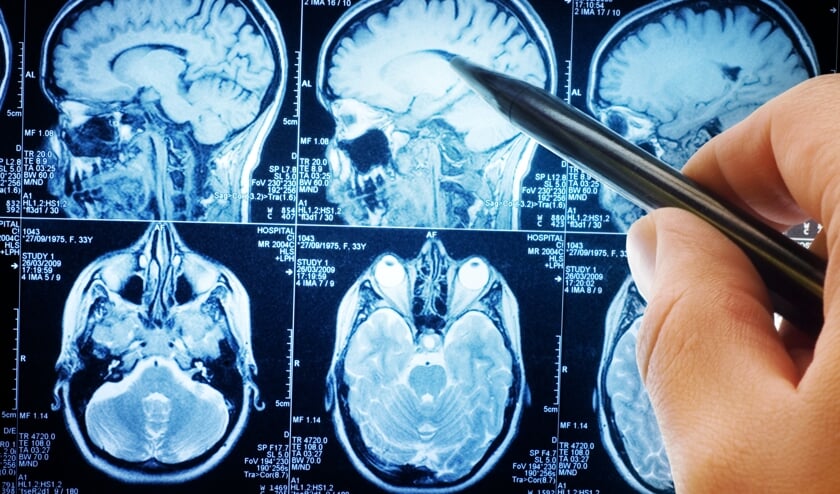 <p>Er zijn ongeveer 650.000 Nederlanders met niet-aangeboren hersenletsel. Goede ondersteuning helpt hen om hun leven weer op te kunnen pakken na zo'n trauma.</p>