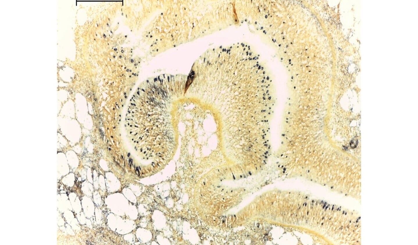H Figuur 1. Microscopisch beeld van Bonamia parasiet (kleine donkerblauwe bolletjes) in oesterweefsel.
