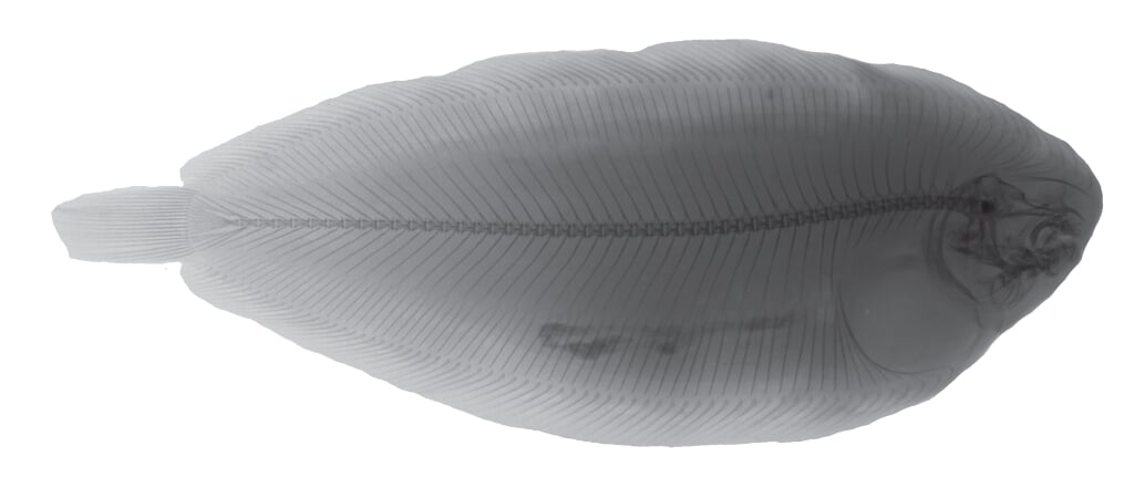 H Duizenden met en zonder puls gevangen vissen zijn in Wageningen onderzocht op letsel aan de wervelkolom. Hier een röntgenfoto van een tong (Solea solea), de belangrijkste doelsoort in de pulsvisserij. (Foto : Remco P.M. Pieters, Leerstoelgroep Experimentele Zoölogie).