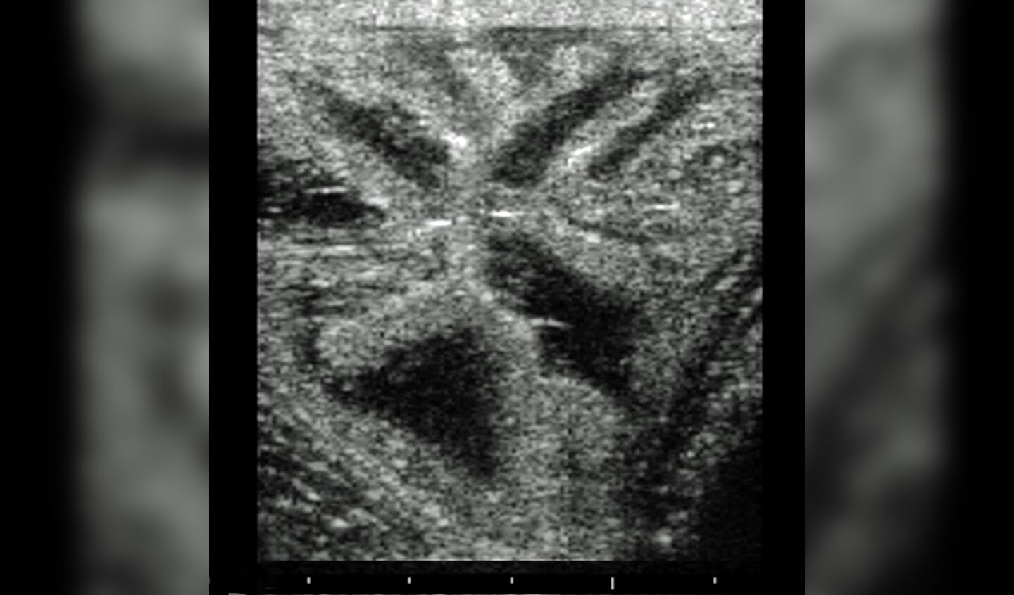 © DigiShotsHengstige merrieOvulatoire follikel Wagenwiel, duidelijk oedeem in baarmoederVeulen na keizersnedeMerrie en veulen na keizersnede
