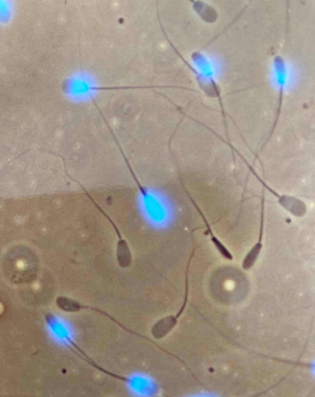 Een eicel rondom zaadcellen bij zoogdieren. (foto: Nanke den Daas)